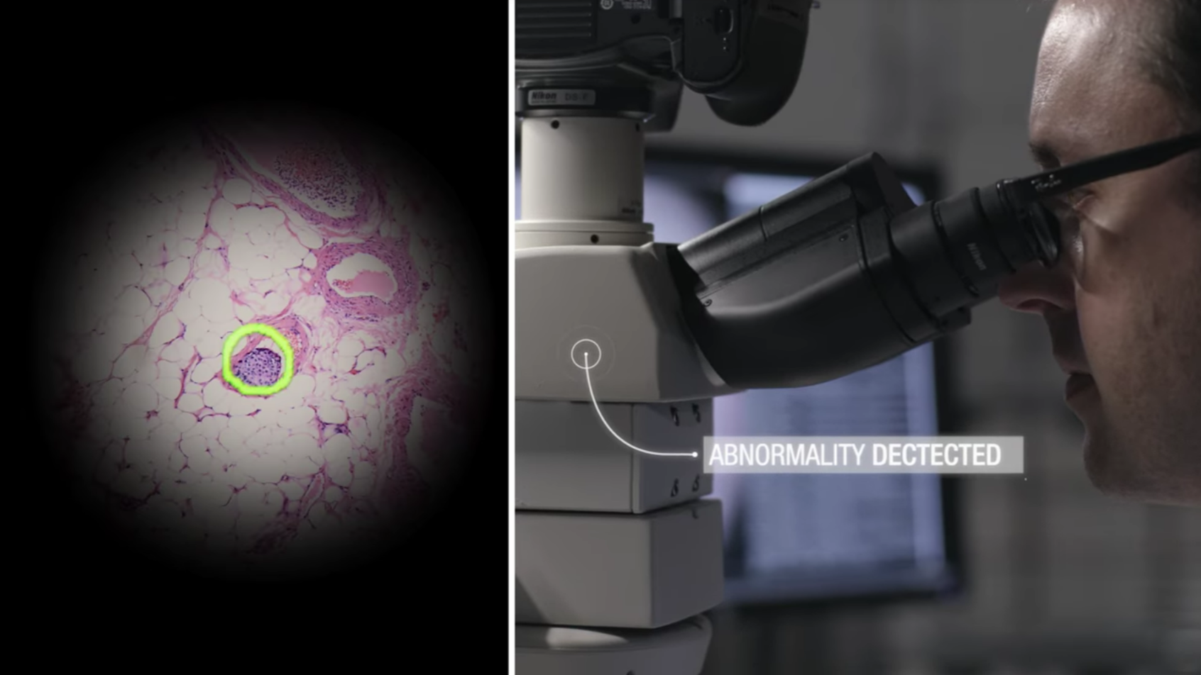 Un microscope AR pour détecter les cancers
